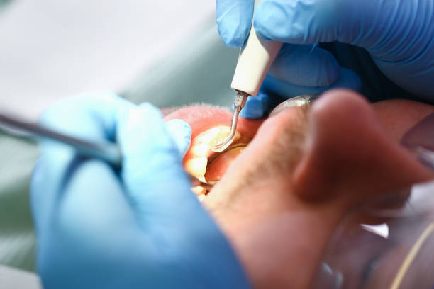 Best After-Hours Emergency Dentist in Mattawan, MI