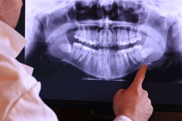 Best Emergency Broken Tooth Repair in Mattawan, MI