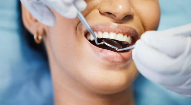 Best Same-Day Emergency Dentist in Mattawan, MI